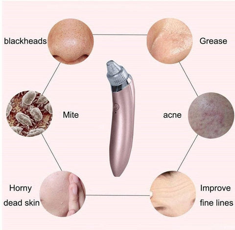 4 in 1 Blackhead Removal Machine - Nooraxo